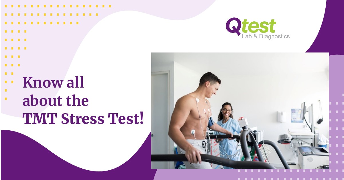 know-all-about-the-tmt-stress-test-qtest-diagnostics